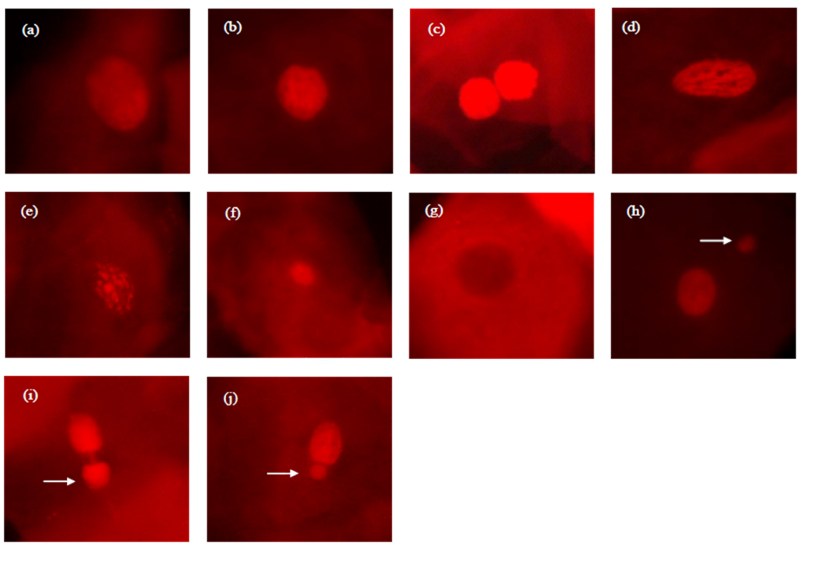 Images of different types of nuclear changes detected in buccal cells
